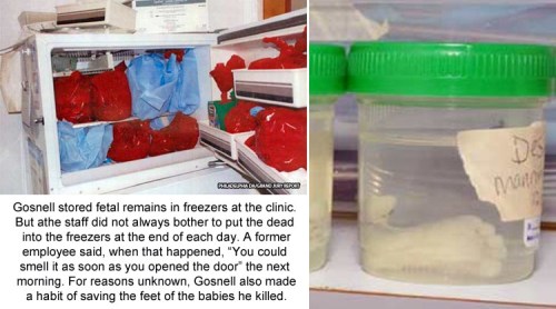Gosnell baby parts