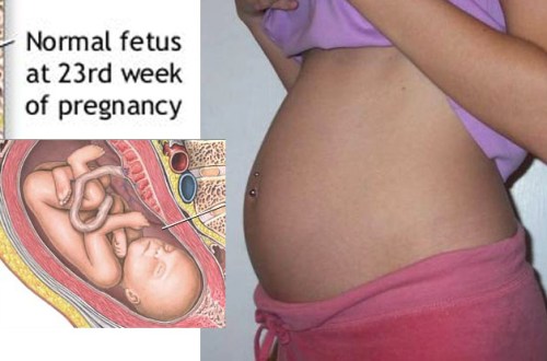 23 weeks more images