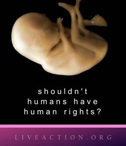UNBORN Shouldn't humans have human rights