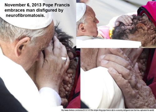 2013_11 06 Pope Francis embraces disfigured man