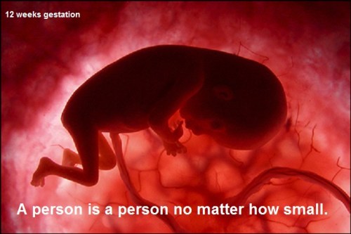 ABORTION 12 weeks fetus