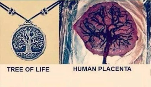 Tree of Life - Placenta