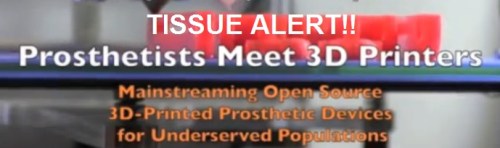 3D prosthetic printing