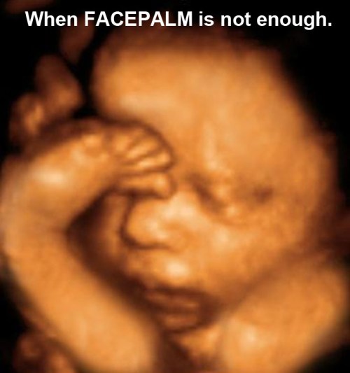 When FACEPALM is not enough