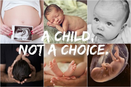 ABORTION A child not a choice