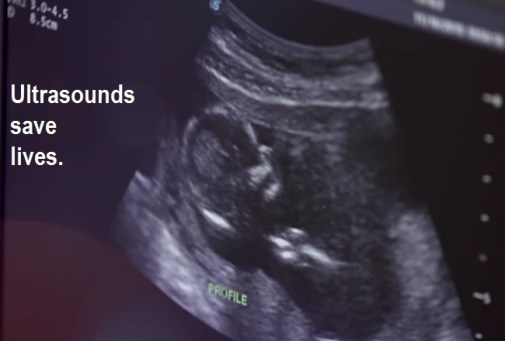 Ultrasounds save lives
