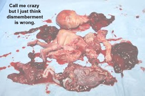 abortion-dismemberment-is-wrong