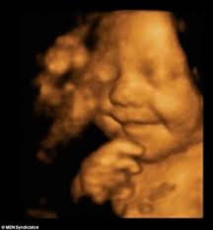 3D ultrasound - big smile