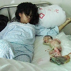 Forced abortion in China