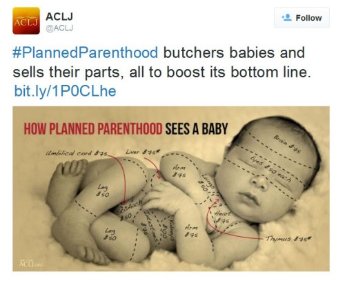 ABORTION PP butchers babies