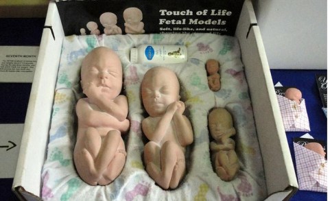 2018_08 14 Fetal models