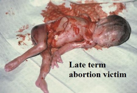 latetermabortionvictim