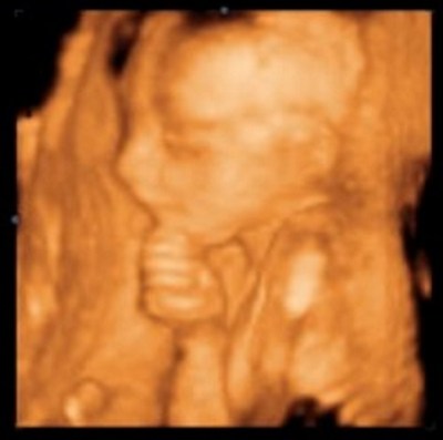3D in utero The Thinker