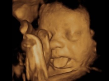 3d in utero tongue out
