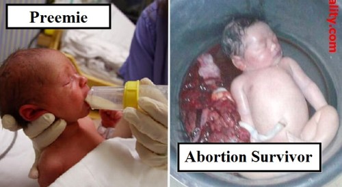 Preemie v Abortion