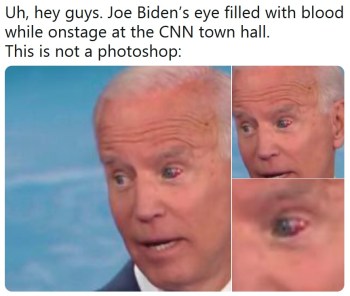 2020 Joe bloody eye