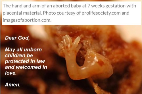 2020_01 22 Unborn prayer