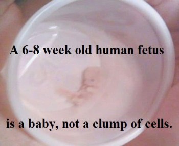 2020_04 18 6-8 week fetus